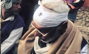 महतोको स्वास्थ्य परिक्षणको रिपोर्ट: एक्स रे सामान्य, भिटामिनको कमीले कमजोरी